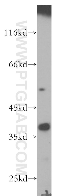 Western Blot (WB) analysis of human adrenal gland tissue using CYLC2 Polyclonal antibody (18729-1-AP)