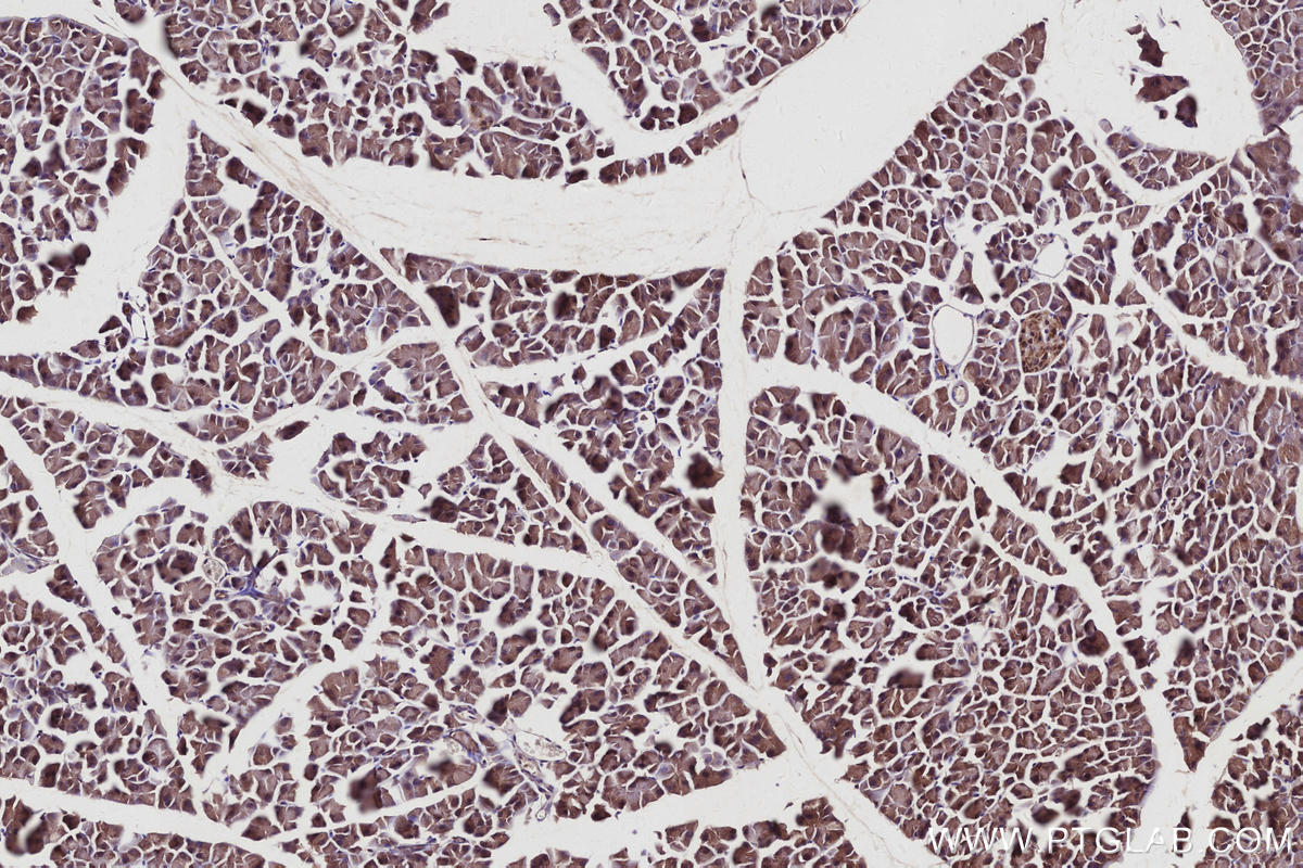 Immunohistochemistry (IHC) staining of mouse pancreas tissue using CYLD Polyclonal antibody (11110-1-AP)
