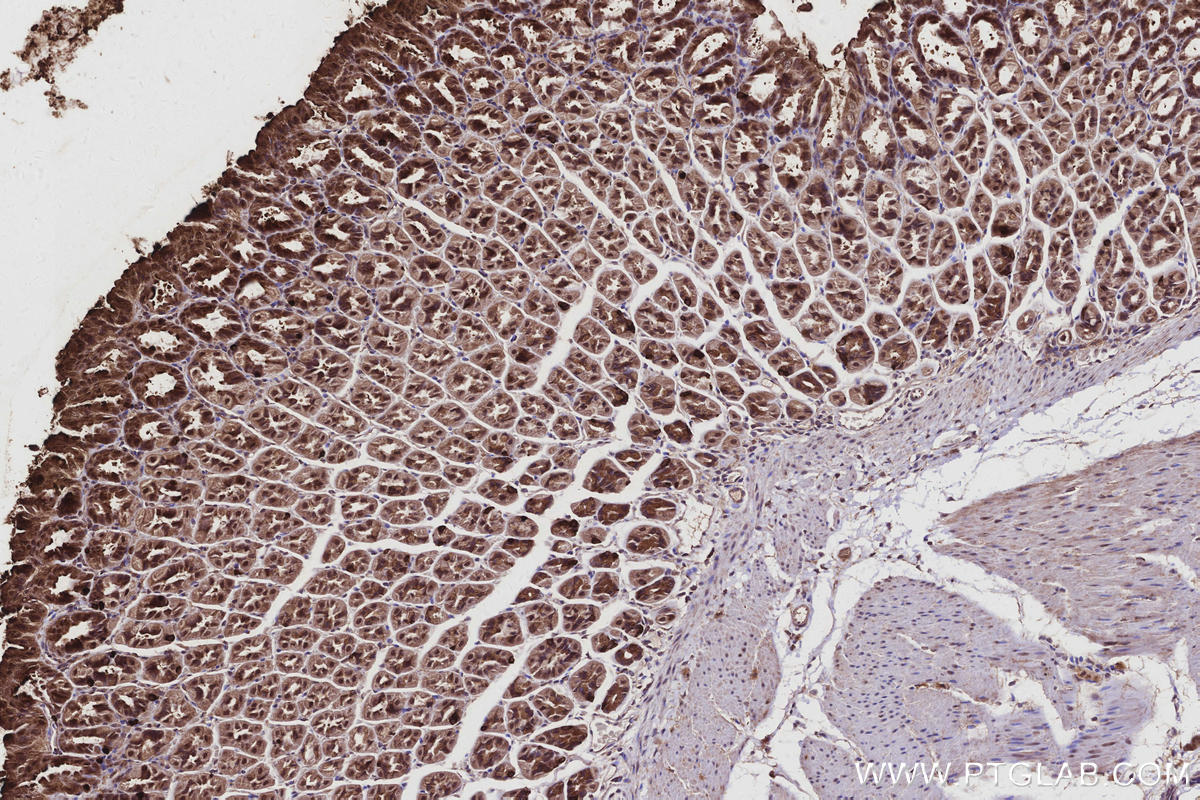 Immunohistochemistry (IHC) staining of mouse stomach tissue using CYLD Polyclonal antibody (11110-1-AP)
