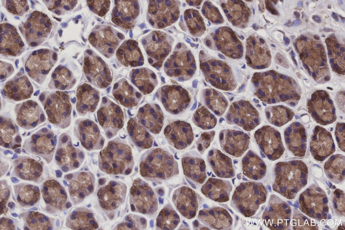Immunohistochemistry (IHC) staining of rat stomach tissue using CYLD Polyclonal antibody (11110-1-AP)