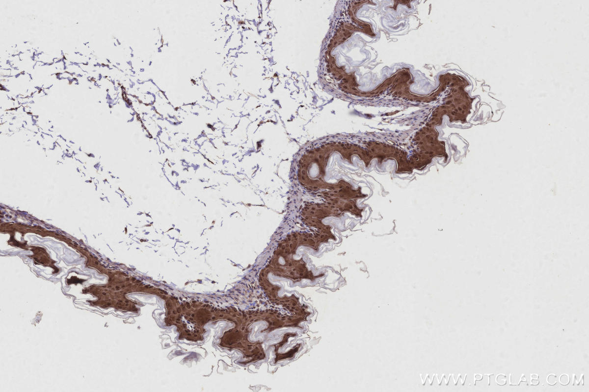 Immunohistochemistry (IHC) staining of mouse stomach tissue using CYLD Polyclonal antibody (11110-1-AP)
