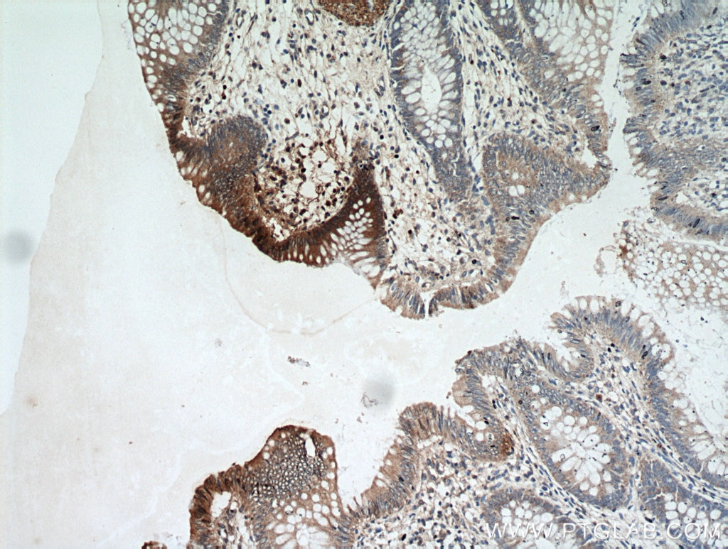 Immunohistochemistry (IHC) staining of human colon tissue using CYLD Polyclonal antibody (11110-1-AP)