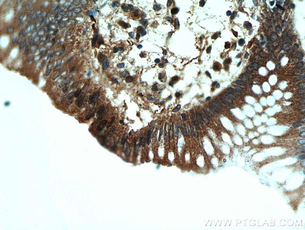 IHC staining of human colon using 11110-1-AP
