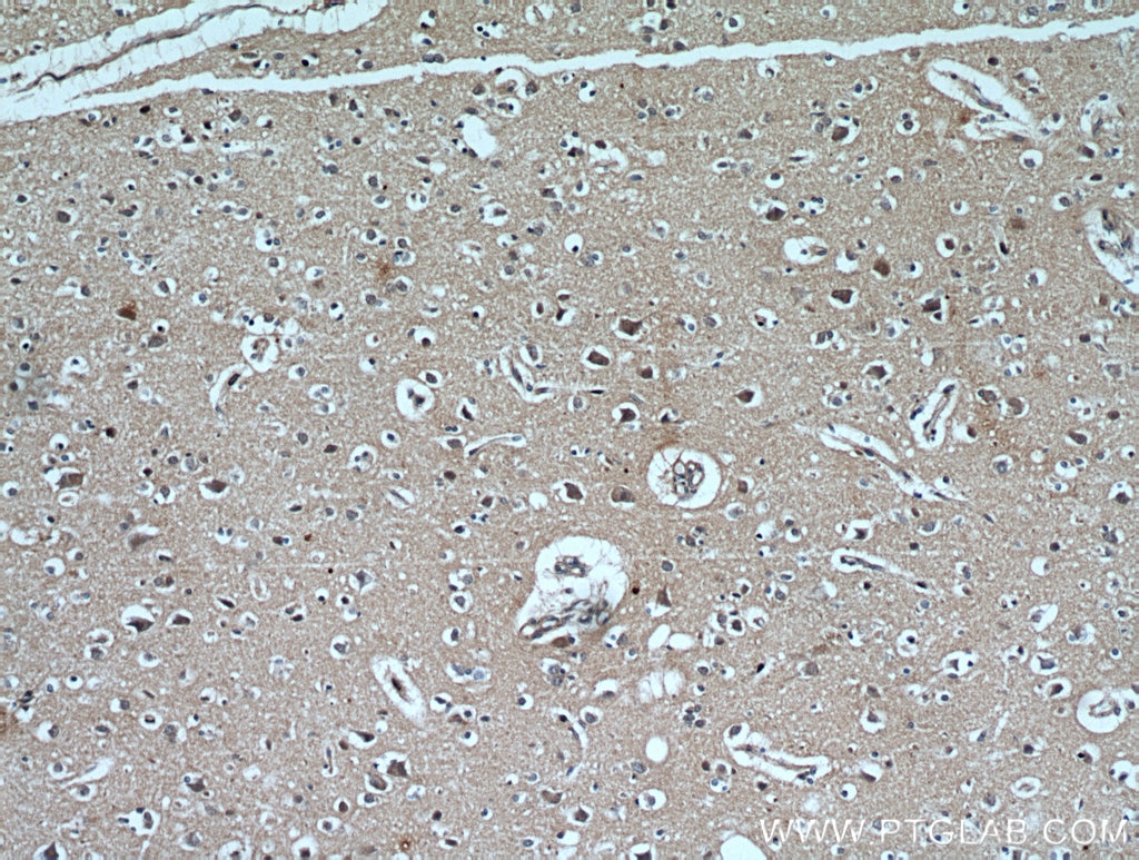 Immunohistochemistry (IHC) staining of human brain tissue using CYLD Polyclonal antibody (11110-1-AP)