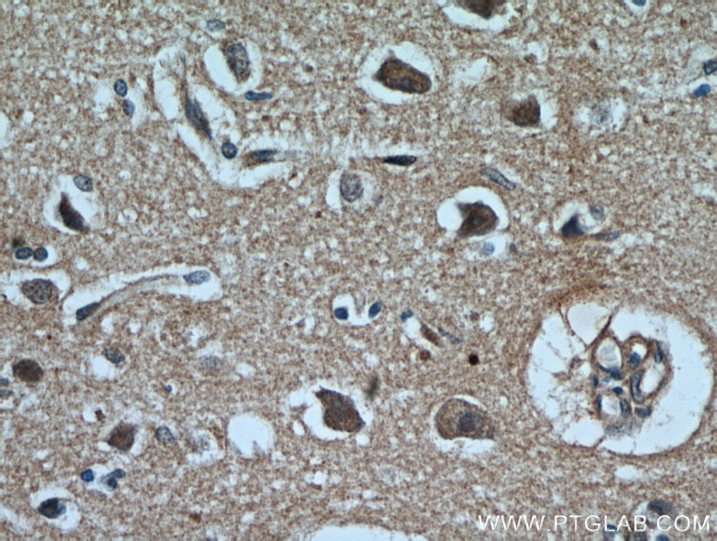 Immunohistochemistry (IHC) staining of human brain tissue using CYLD Polyclonal antibody (11110-1-AP)