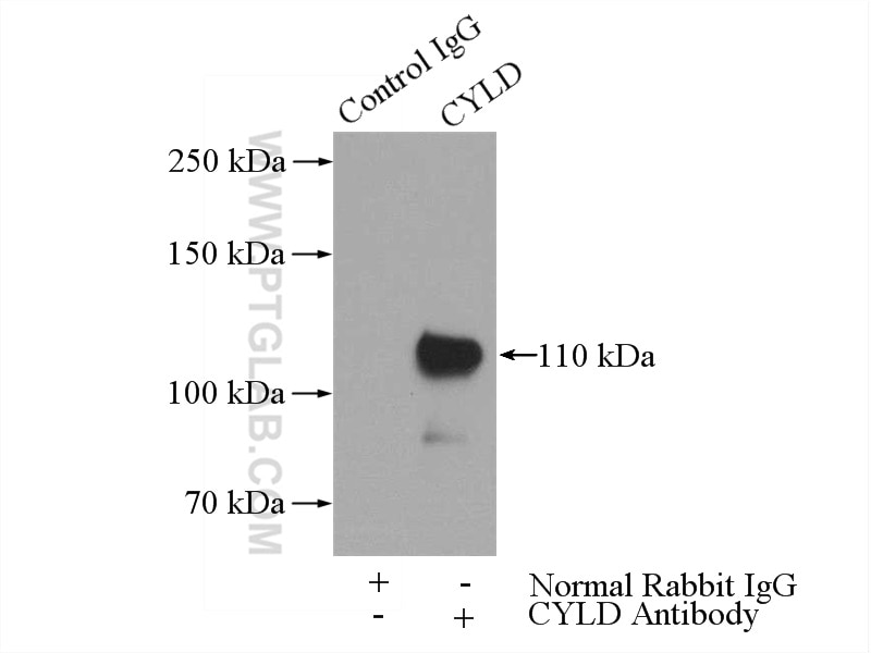 Immunoprecipitation (IP) experiment of mouse brain tissue using CYLD Polyclonal antibody (11110-1-AP)
