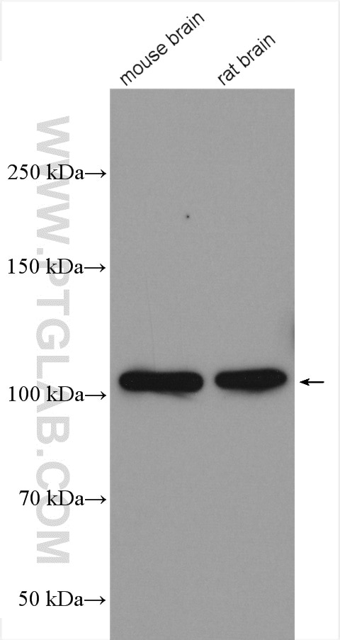 Western Blot (WB) analysis of various lysates using CYLD Polyclonal antibody (11110-1-AP)