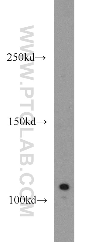 Western Blot (WB) analysis of Jurkat cells using CYLD Polyclonal antibody (11110-1-AP)