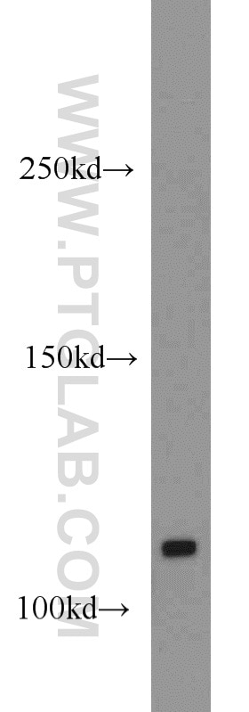 Western Blot (WB) analysis of A431 cells using CYLD Polyclonal antibody (11110-1-AP)