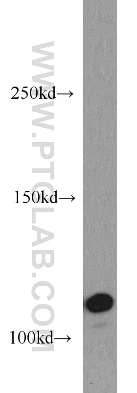 Western Blot (WB) analysis of A431 cells using CYLD Polyclonal antibody (11110-1-AP)