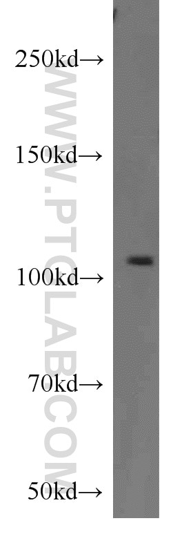Western Blot (WB) analysis of HEK-293 cells using CYLD Polyclonal antibody (11110-1-AP)