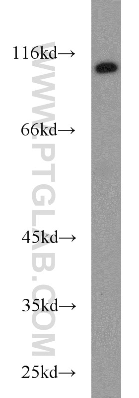 Western Blot (WB) analysis of mouse brain tissue using CYLD Polyclonal antibody (11110-1-AP)