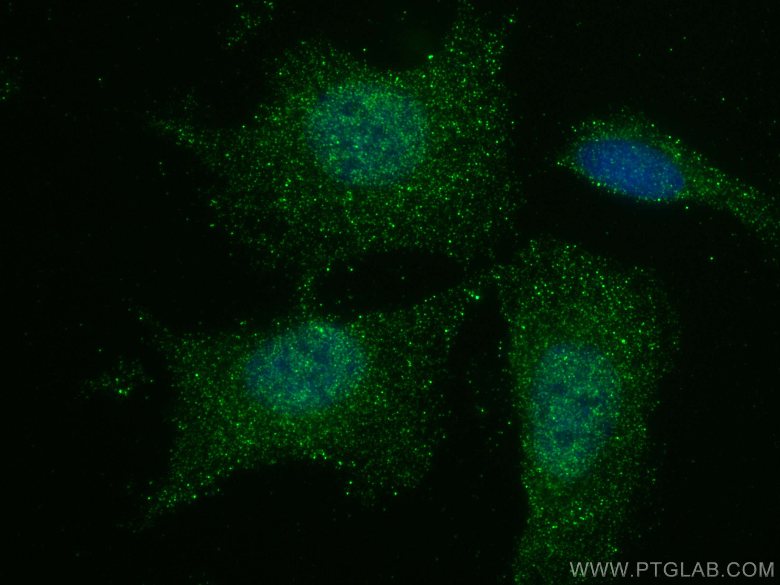 Immunofluorescence (IF) / fluorescent staining of SH-SY5Y cells using CYLD Monoclonal antibody (66858-1-Ig)