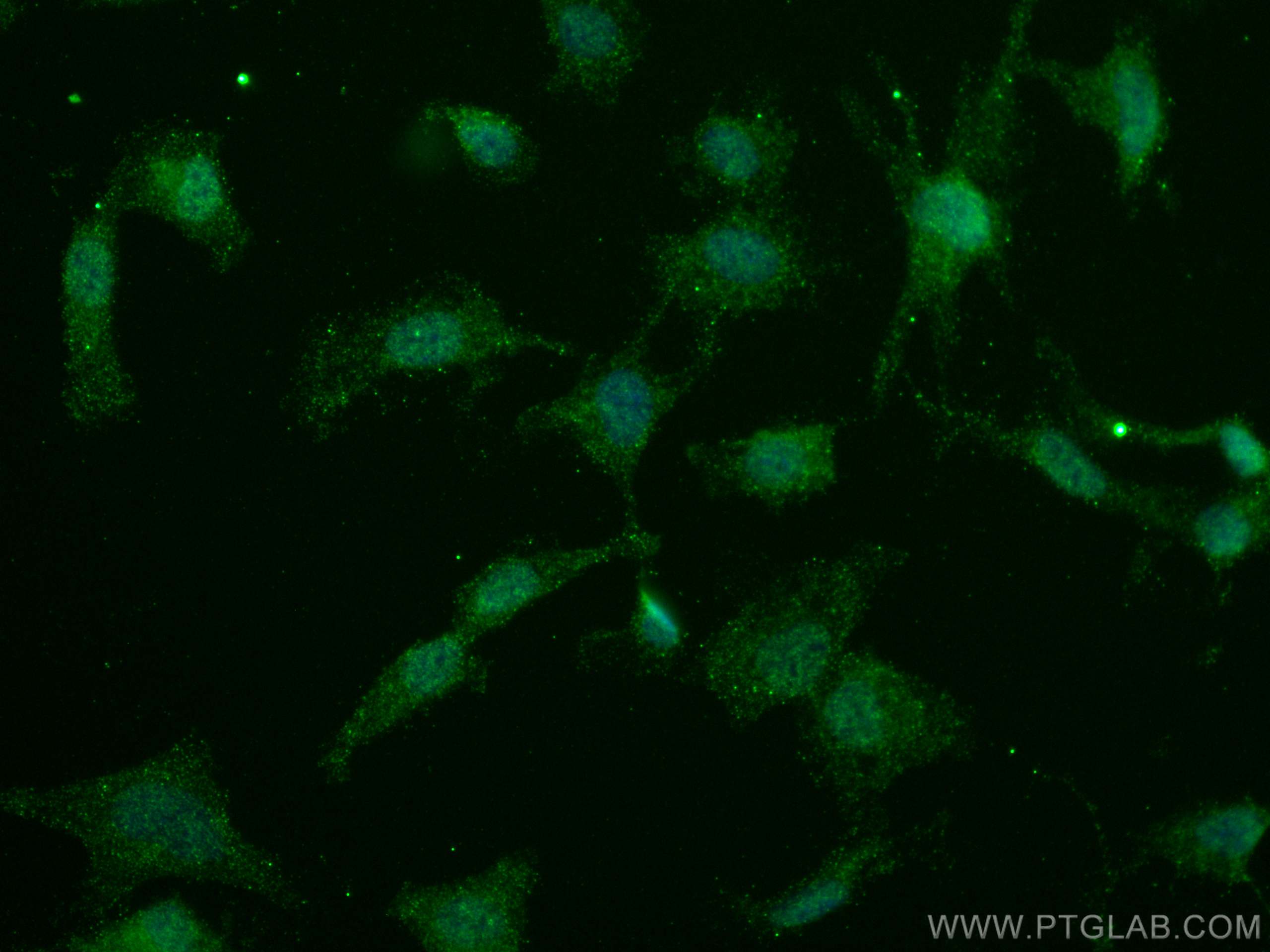 Immunofluorescence (IF) / fluorescent staining of SH-SY5Y cells using CYLD Monoclonal antibody (66858-1-Ig)