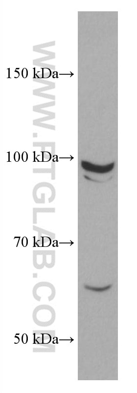 Western Blot (WB) analysis of HEK-293 cells using CYLD Monoclonal antibody (66858-1-Ig)