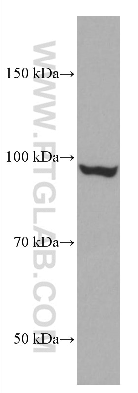 Western Blot (WB) analysis of A431 cells using CYLD Monoclonal antibody (66858-1-Ig)