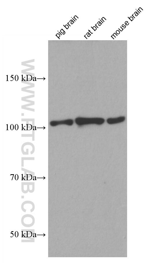 Western Blot (WB) analysis of various lysates using CYLD Monoclonal antibody (66858-1-Ig)