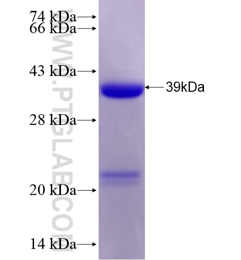 CYLD fusion protein Ag28333 SDS-PAGE