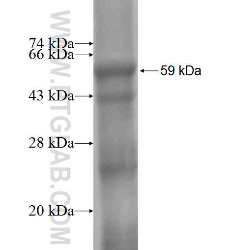 CYLD fusion protein Ag1598 SDS-PAGE