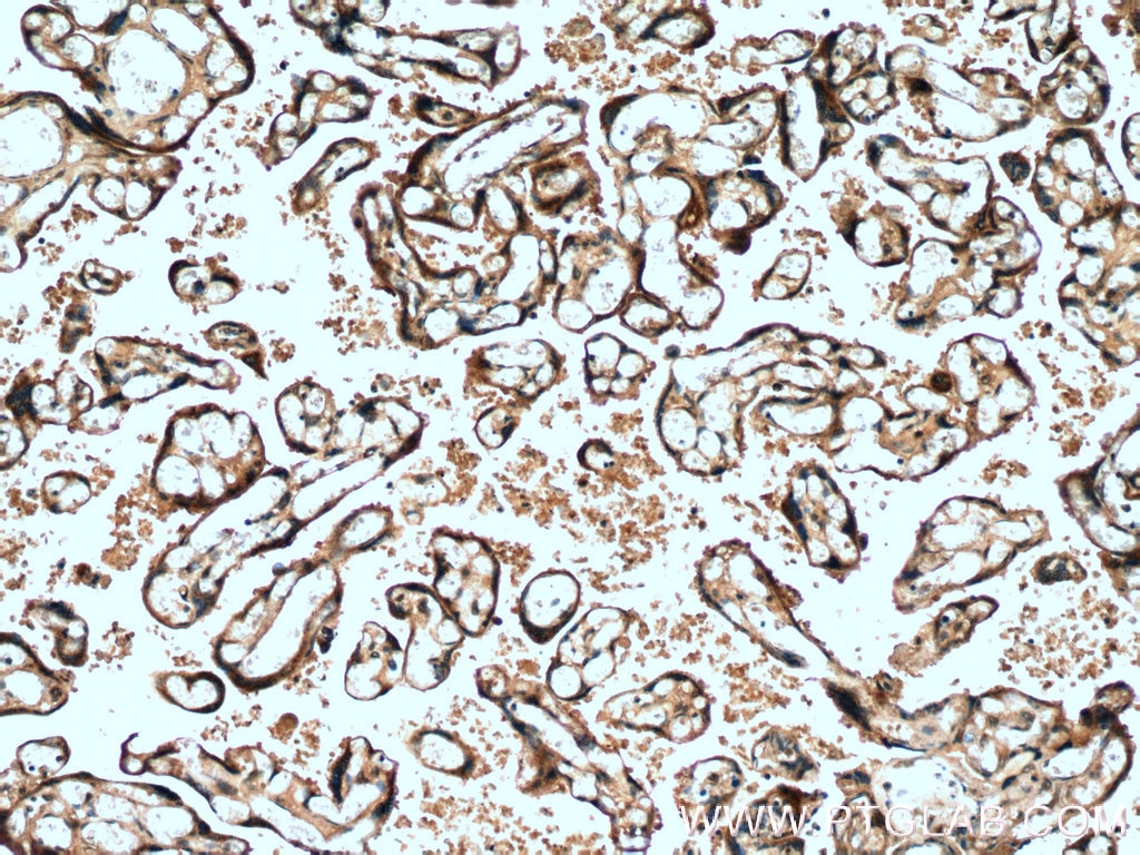 Immunohistochemistry (IHC) staining of human placenta tissue using CYP11A1 Polyclonal antibody (13363-1-AP)