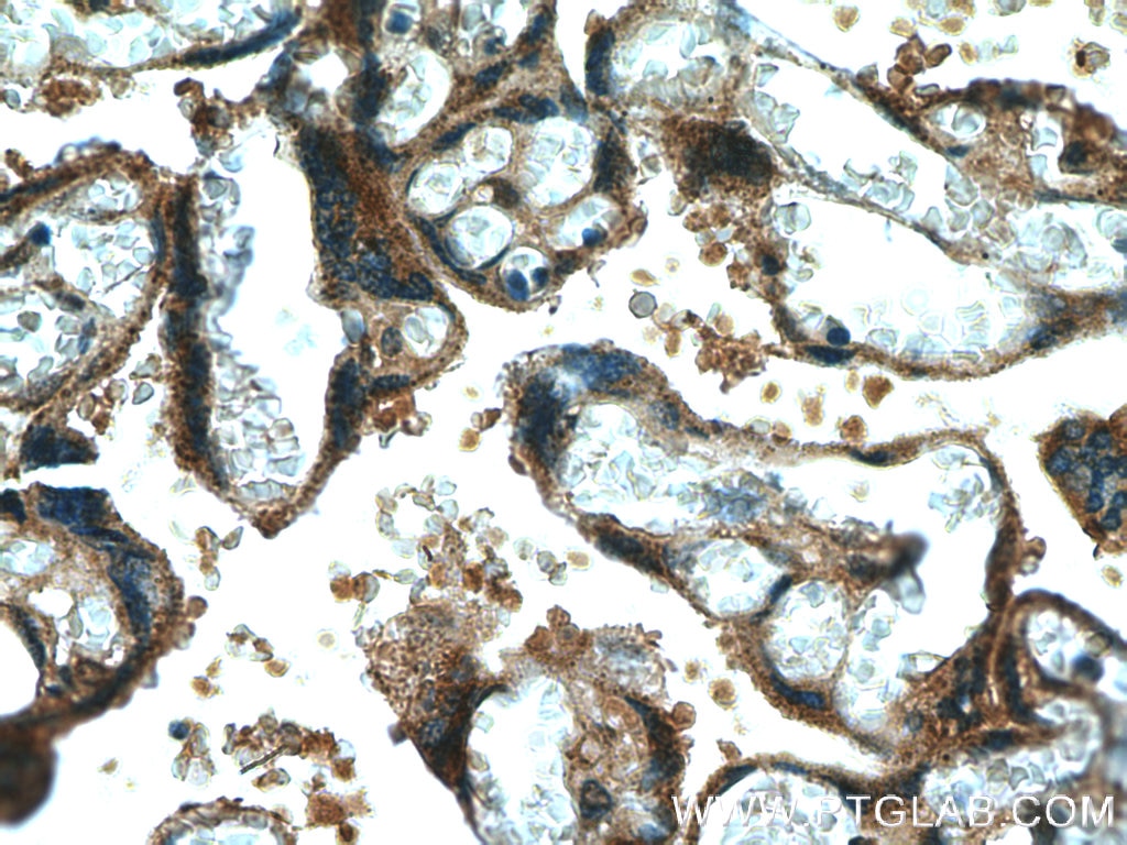 Immunohistochemistry (IHC) staining of human placenta tissue using CYP11A1 Polyclonal antibody (13363-1-AP)