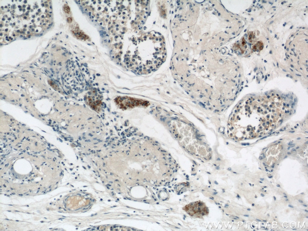 Immunohistochemistry (IHC) staining of human testis tissue using CYP11A1 Polyclonal antibody (13363-1-AP)