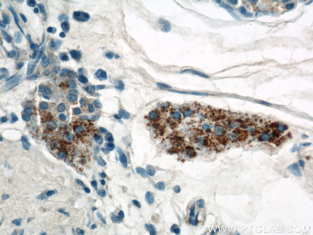 Immunohistochemistry (IHC) staining of human testis tissue using CYP11A1 Polyclonal antibody (13363-1-AP)