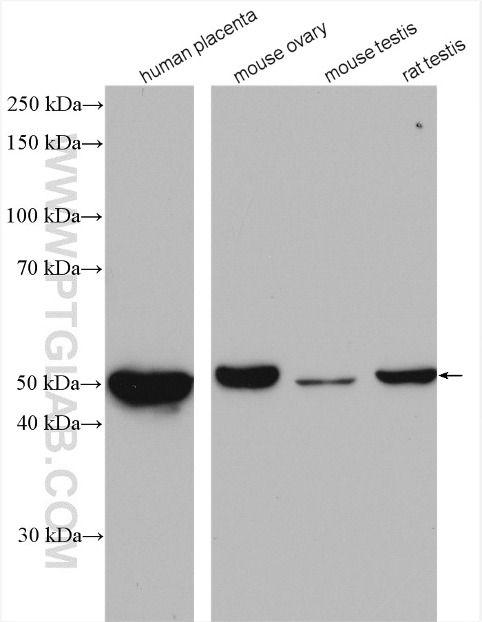 Western Blot (WB) analysis of various lysates using CYP11A1 Polyclonal antibody (13363-1-AP)