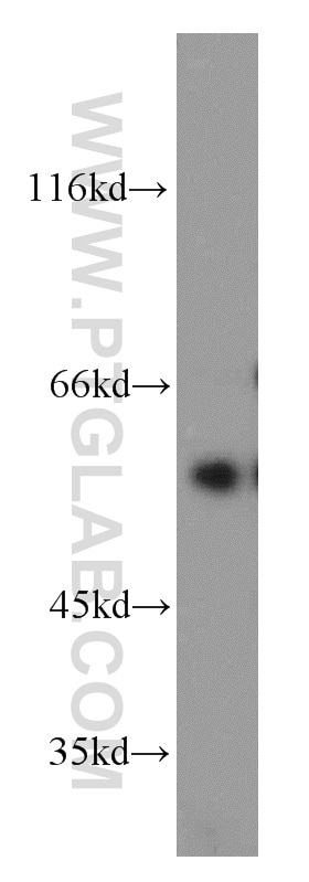 Western Blot (WB) analysis of HeLa cells using CYP11A1 Polyclonal antibody (13363-1-AP)