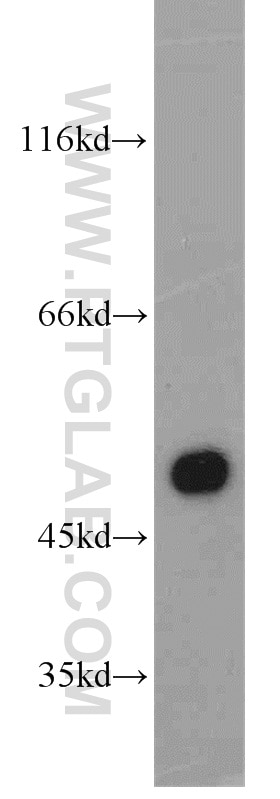 Western Blot (WB) analysis of human placenta tissue using CYP11A1 Polyclonal antibody (13363-1-AP)