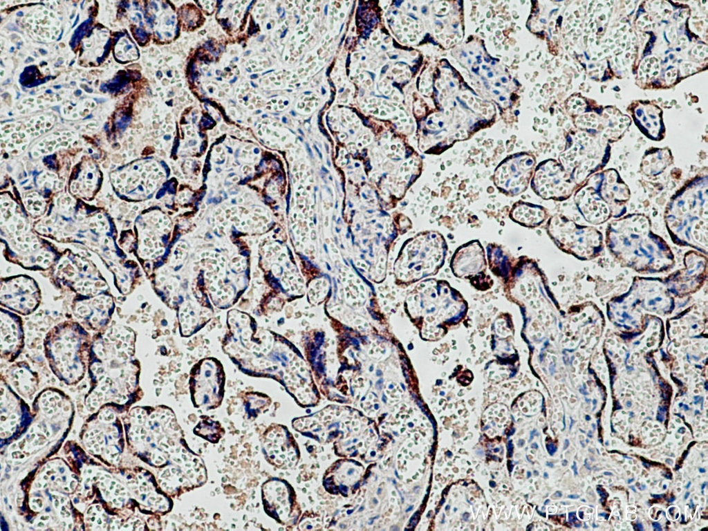 Immunohistochemistry (IHC) staining of human placenta tissue using CYP11A1 Monoclonal antibody (67264-1-Ig)