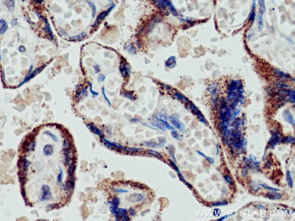 Immunohistochemistry (IHC) staining of human placenta tissue using CYP11A1 Monoclonal antibody (67264-1-Ig)