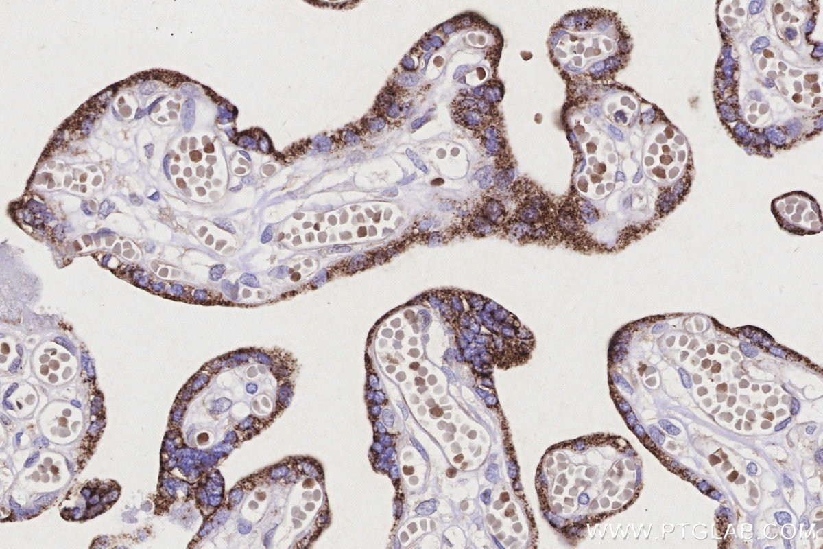 IHC staining of human placenta using 67264-1-Ig Immunohistochemistry (IHC) staining of human placenta tissue using CYP11A1 Monoclonal antibody (67264-1-Ig)