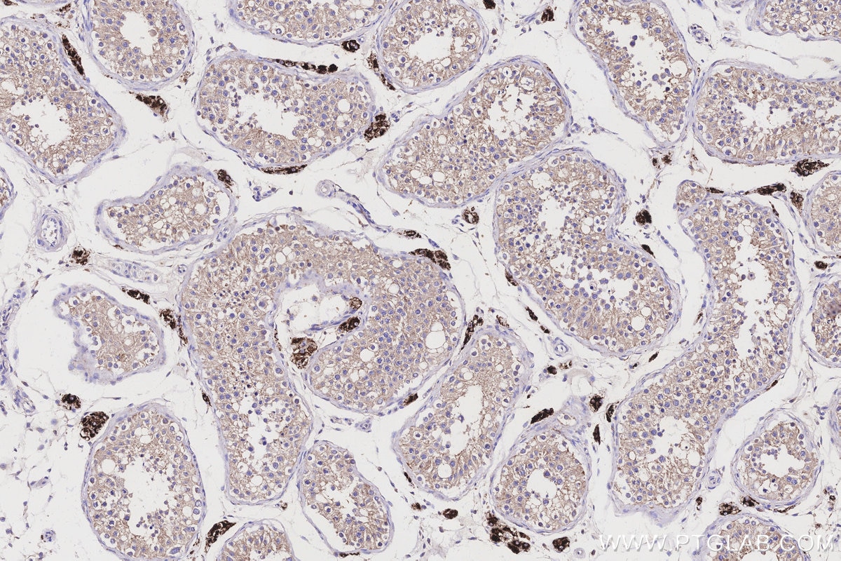 IHC staining of human testis using 67264-1-Ig Immunohistochemistry (IHC) staining of human testis tissue using CYP11A1 Monoclonal antibody (67264-1-Ig)