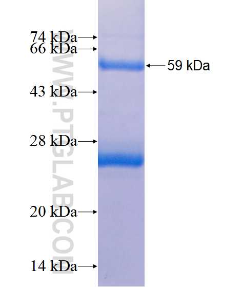 CYP11A1 fusion protein Ag4182 SDS-PAGE