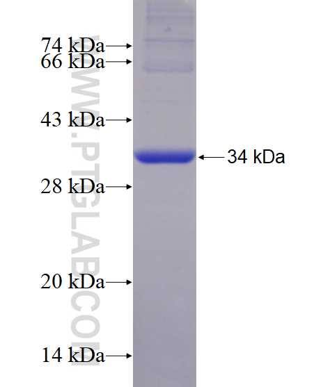 CYP11A1 fusion protein Ag4353 SDS-PAGE