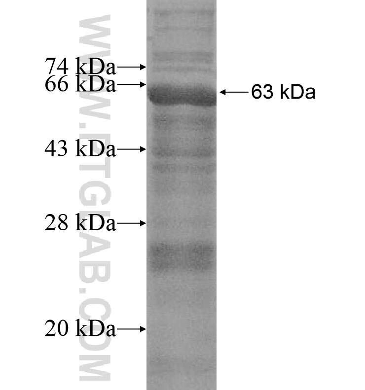 CYP11B1 fusion protein Ag16382 SDS-PAGE