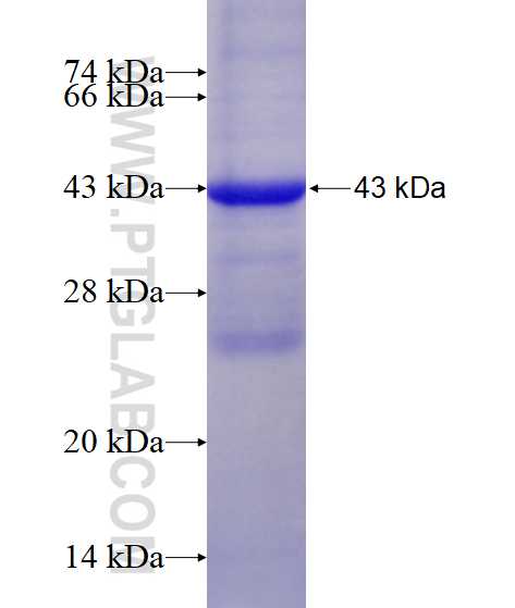 CYP11B1 fusion protein Ag17158 SDS-PAGE