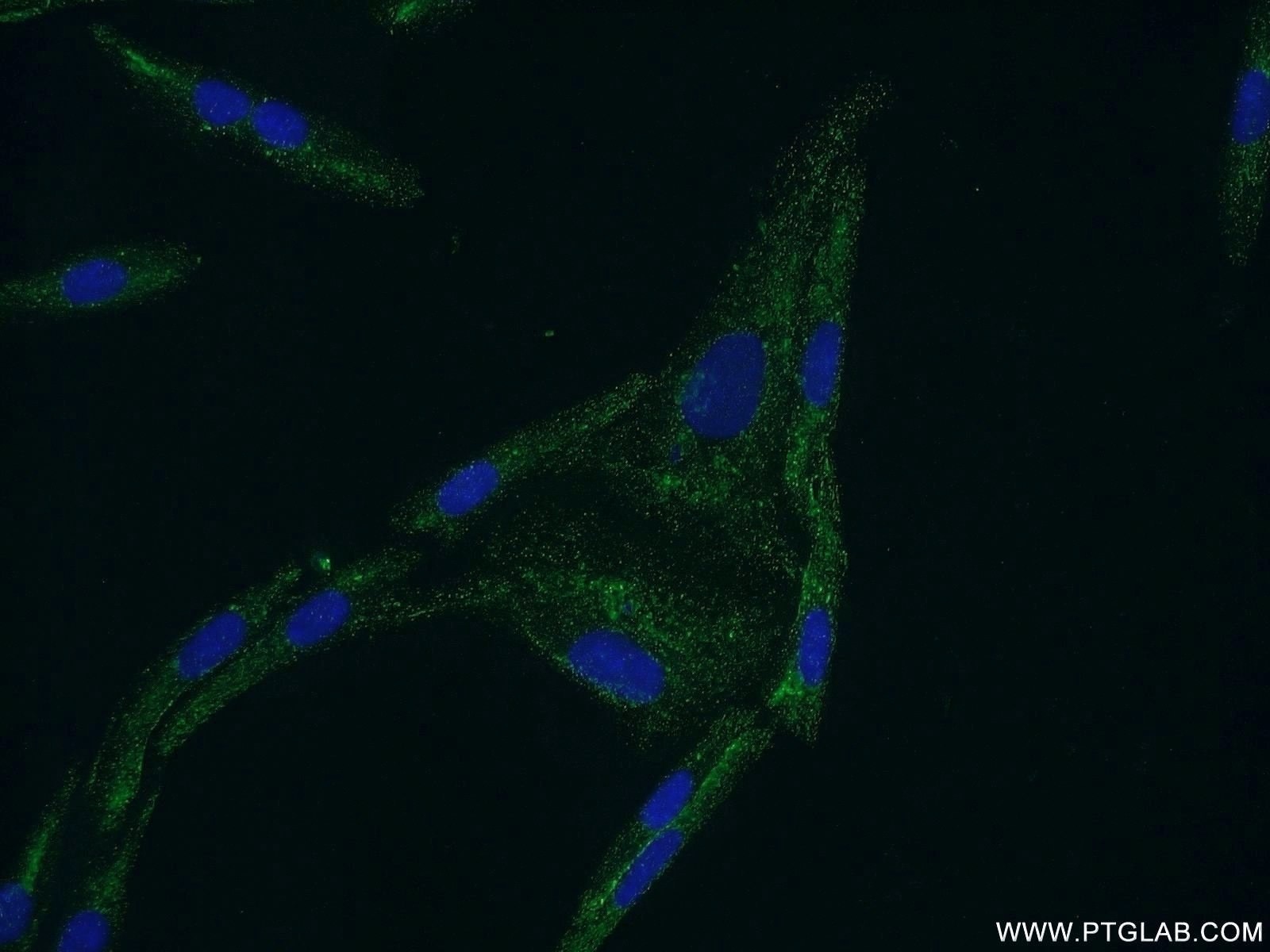 Immunofluorescence (IF) / fluorescent staining of SKOV-3 cells using CYP11B2 Polyclonal antibody (20968-1-AP)