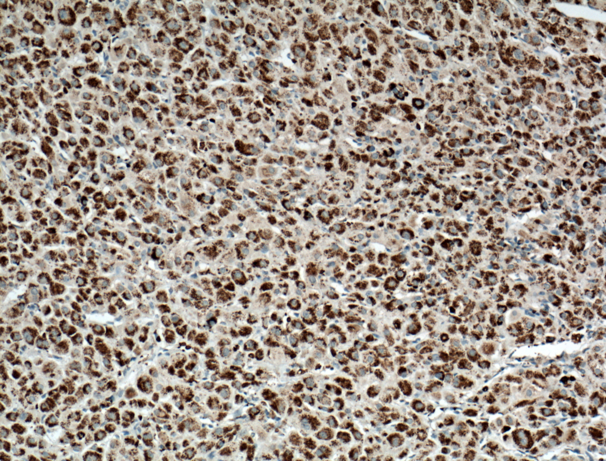 Immunohistochemistry (IHC) staining of human adrenal gland tissue using CYP11B2 Polyclonal antibody (20968-1-AP)