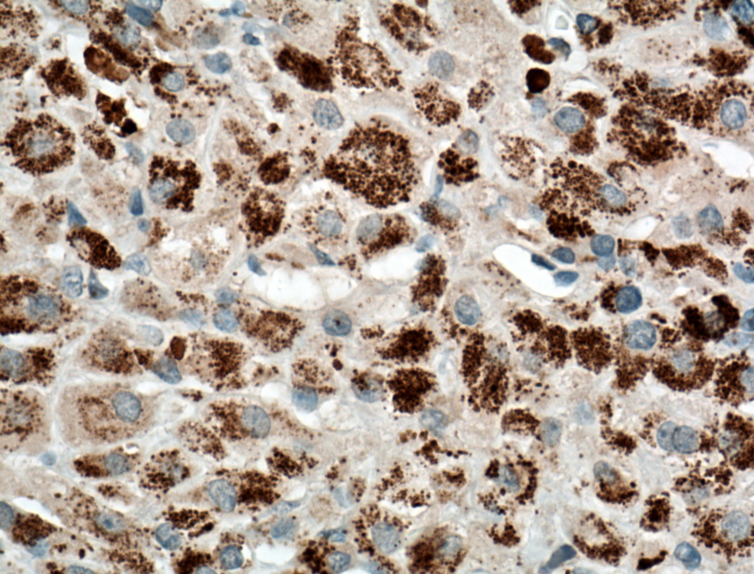 Immunohistochemistry (IHC) staining of human adrenal gland tissue using CYP11B2 Polyclonal antibody (20968-1-AP)