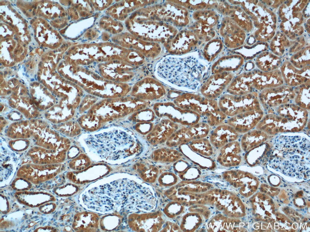 Immunohistochemistry (IHC) staining of human kidney tissue using CYP11B2 Polyclonal antibody (20968-1-AP)