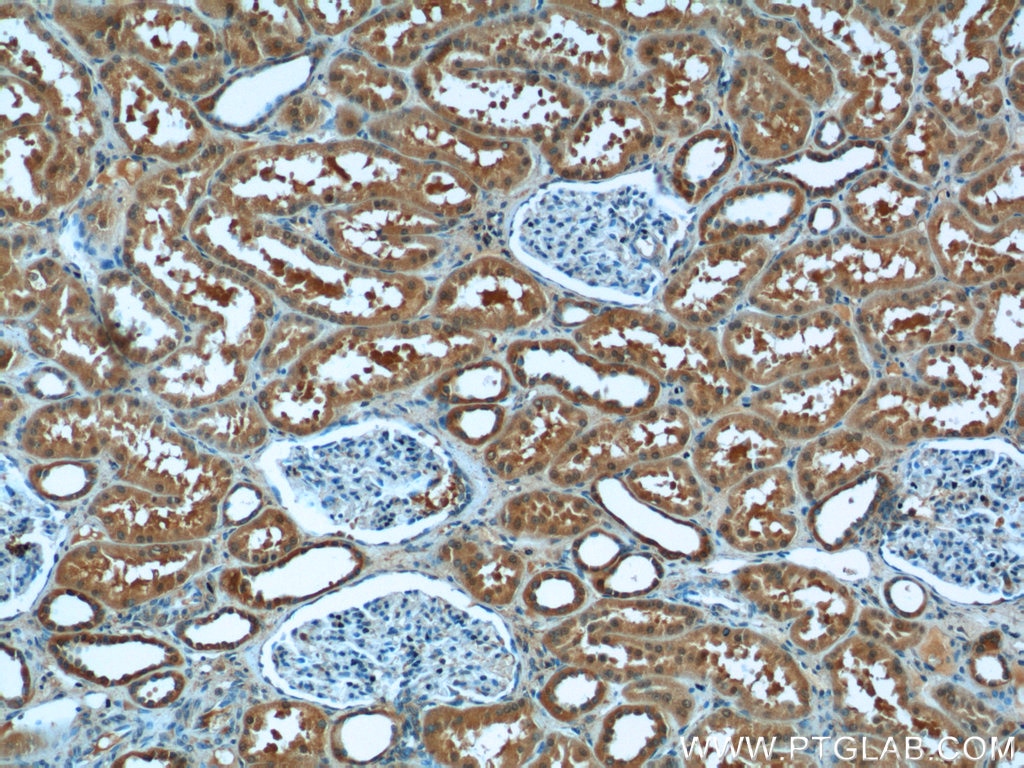 IHC staining of human kidney using 20968-1-AP