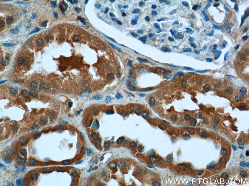 Immunohistochemistry (IHC) staining of human kidney tissue using CYP11B2 Polyclonal antibody (20968-1-AP)