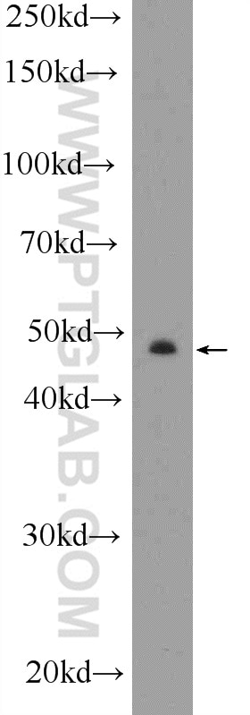 Western Blot (WB) analysis of SKOV-3 cells using CYP11B2 Polyclonal antibody (20968-1-AP)