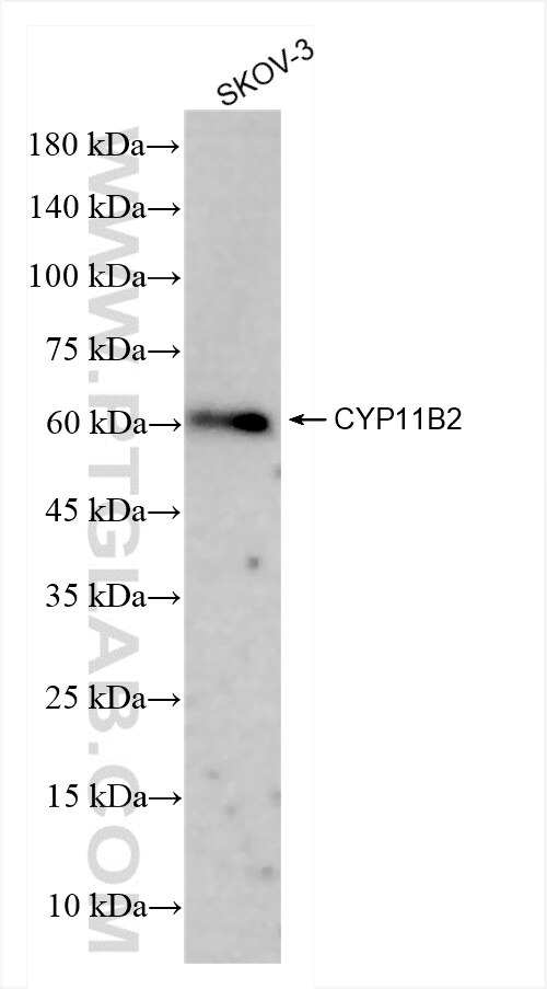 Western Blot (WB) analysis of SKOV-3 cells using CYP11B2 Recombinant antibody (83930-1-RR)