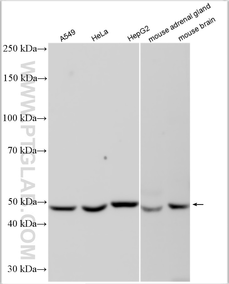 Western Blot (WB) analysis of various lysates using CYP17A1 Polyclonal antibody (14447-1-AP)