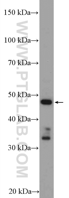 Western Blot (WB) analysis of rat brain tissue using CYP17A1 Polyclonal antibody (14447-1-AP)