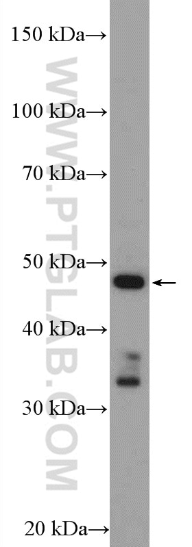 WB analysis of rat brain using 14447-1-AP