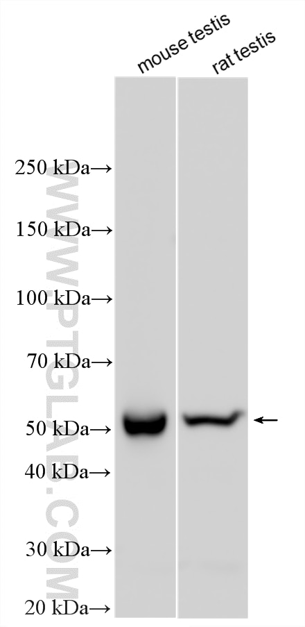 Western Blot (WB) analysis of various lysates using CYP17A1 Polyclonal antibody (14447-1-AP)